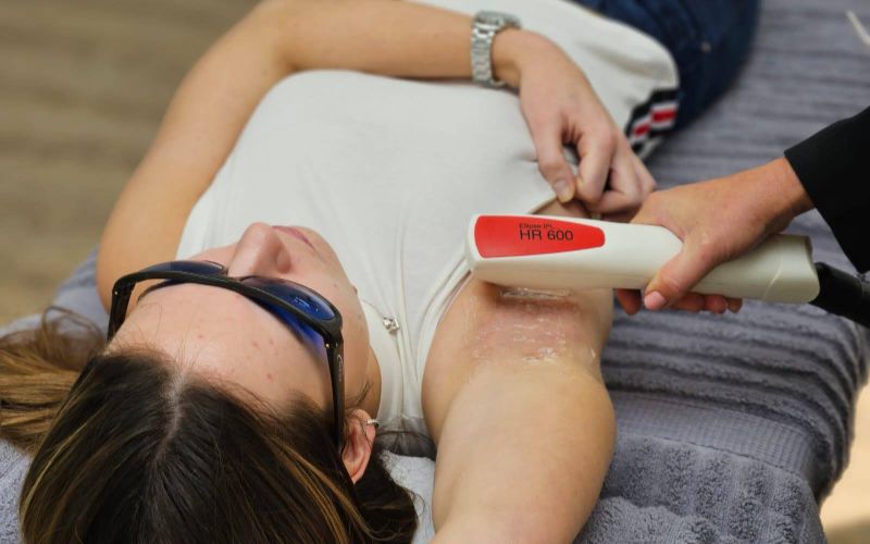 laser-clinic-cape-town-hair-removal-centurion-3-min