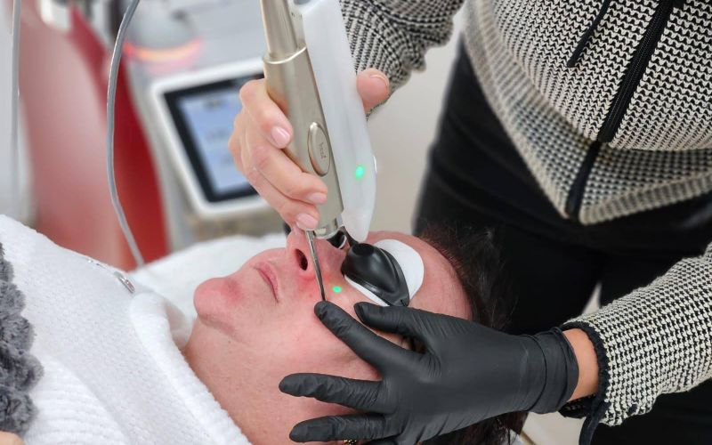 laser-treatment-for-face-face-treatment-min