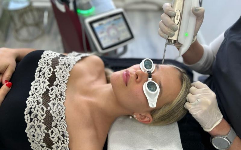 laser-clinic-cape-town-goggles-min