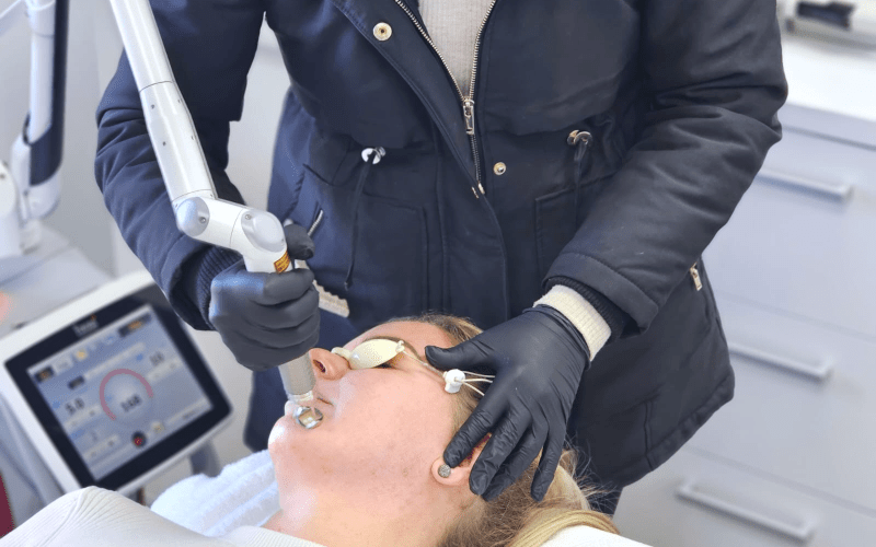 laser-treatment-for-face-side-min