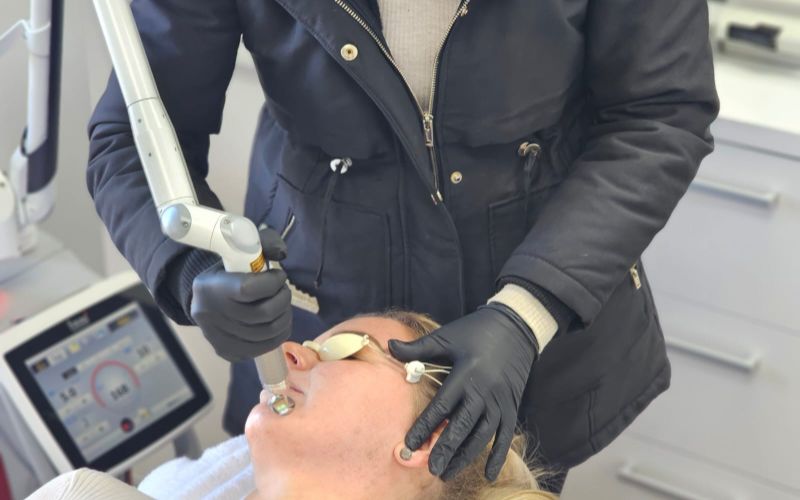 laser-clinic-cape-town-for-face-min
