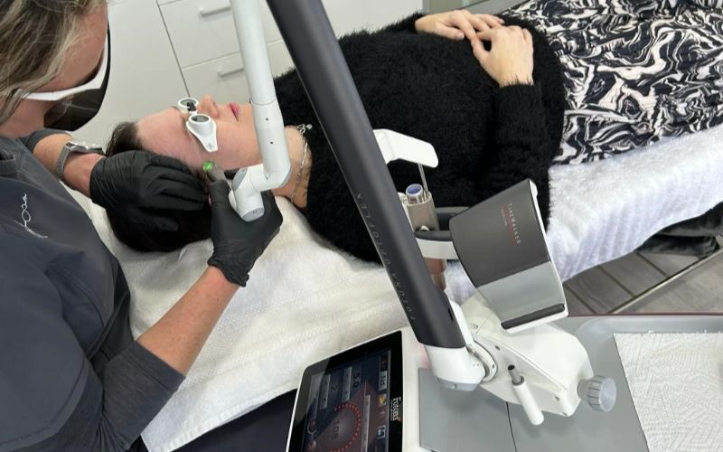 laser-clinic-cape-town-treatment-min