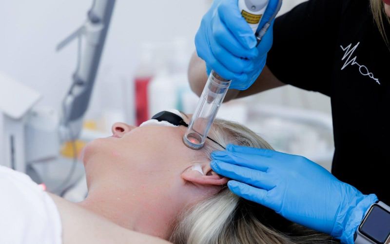 laser-treatment-for-face-rejuvenation-min