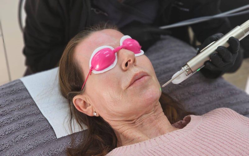 laser-clinic-centurion-face-min