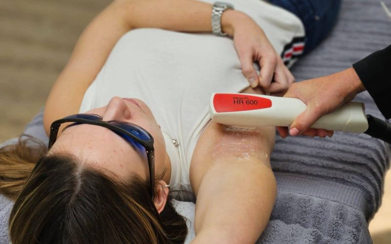 laser-hair-for-removal-centurion-arm (1)