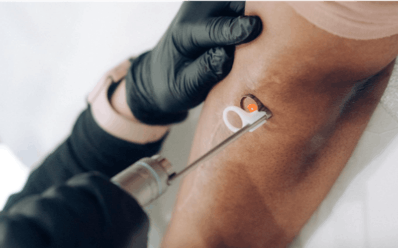 Nuskinnovations close-up of a medical procedure