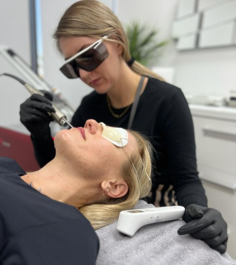 laser-treatment-for-face-lady-lying-on-bed-getting-treatment