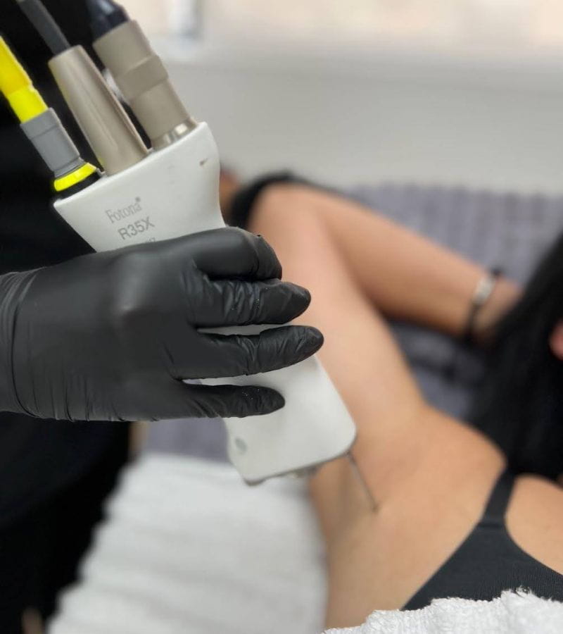 laser-hair-removal-centurion-underarm (1)