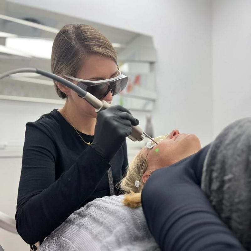 laser-for-hair-removal-at-clinic (1)