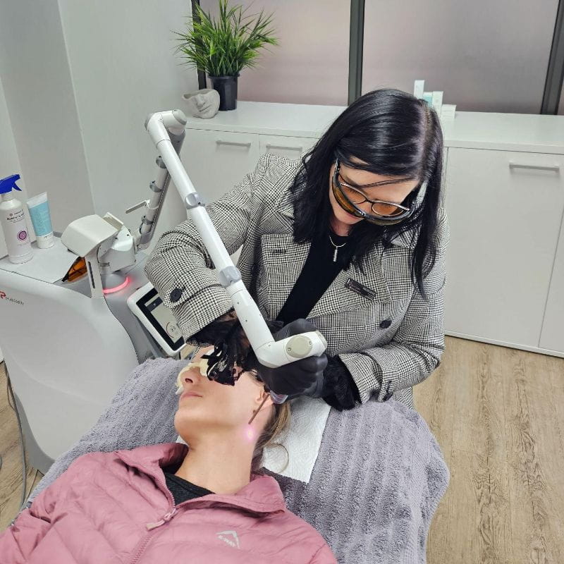 laser-for-hair-removal-facial-hair (1)