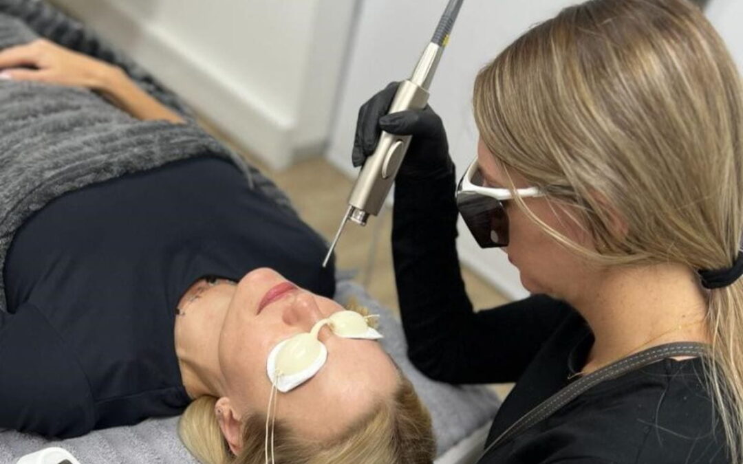 Laser For Hair Removal: What Actually Happens Beneath The Skin