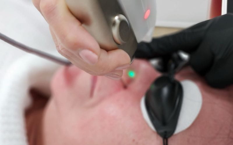 laser-clinic-cape-town-skincare-solutions (1)