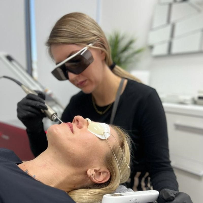 laser-treatment-for-face-at-nuskinnovation