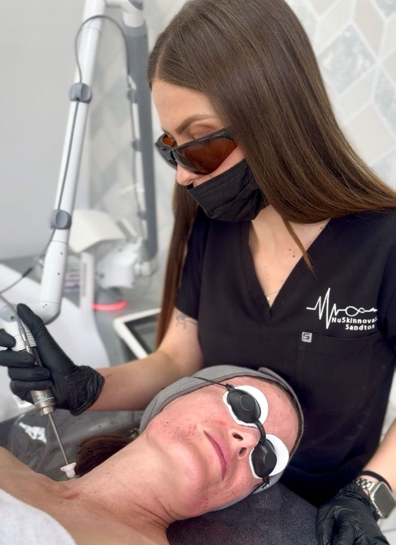 skin-laser-treatment-price-imperfections (1)