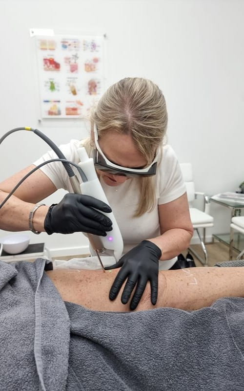 laser-treatment-for-face-procedure (1)