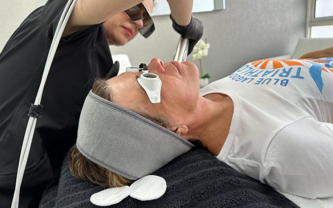 laser-treatment-for-face-concerns (1)